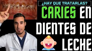 Las CARIES en niños con DIENTES DE LECHE no hace falta tratarlas 🤥¡MENTIRA [upl. by Kester372]