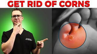 Calluses Foot Corns amp Plantar Wart Removal Top 10 Home Remedies [upl. by Saffren]