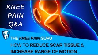 Knee Scar Tissue l How to Reduce Knee Scar Tissue amp Increase FlexibilityRange of Motion [upl. by Nirol]