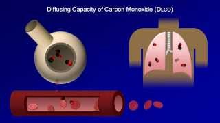 Pulmonary Function Tests PFT Lesson 4  DLCO [upl. by Pembroke]