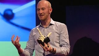 A helping hand with prosthetics Joel Gibbard at TEDxExeter [upl. by Norven]