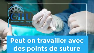 Peut on travailler avec des points de suture [upl. by Narmi]