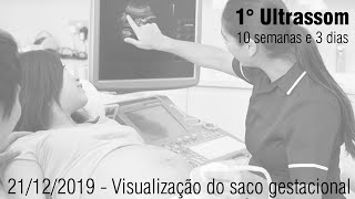 1° Ultrassom 10 semanas e 3 dias [upl. by Truitt]