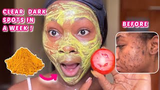 YOU WILL NEVER HAVE DARK SPOTS AGAIN  Get clear skin in a week using tomatoes amp turmeric skincare [upl. by Mcquillin]