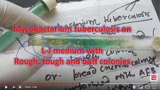 Mycobacterium tuberculosis grown in L J medium [upl. by Pompea]