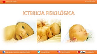 Ictericia Fisiológica  Ictericia neonatal [upl. by Karp]