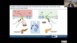 HPSGX  Acute pancreatitis József Maléth [upl. by Elocal]