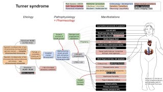 Turner syndrome mechanism of disease [upl. by Asilrahc144]