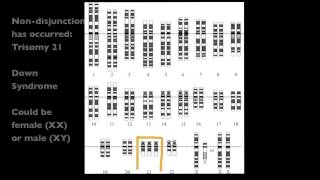 427 Analyze a human karyotype to determine gender and whether nondisjunction has occurred [upl. by Marian]