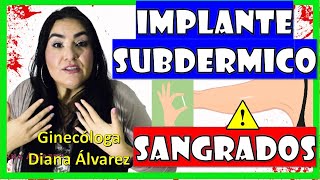 SANGRADOS con IMPLANTE SUBDERMICO ¿Por Qué ¿Qué Hacer por GINECOLOGA DIANA ALVAREZ [upl. by Wehhtam97]