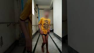 12yrmale with diplegic Cerebral Palsy amp patella alta  6 weeks post op video [upl. by Hildebrandt256]