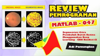 Review Pemrograman MATLAB  047  Segmentasi Citra Pembuluh Darah Retina Menggunakan Deep Learning [upl. by Kere]