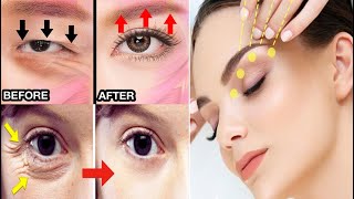 The Ultimate Guide To Fixing Droopy Eyelids Hooded Eye Crows Feet បំបាត់ភ្នែកស្លក់ភ្នែកយាធ្លាក់ [upl. by Einnob200]