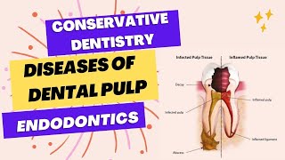 ADC part 1 exam  A simple way to diagnose pulpal diseases [upl. by Gelman]