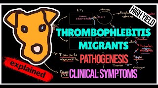 Thrombophlebitis migrants Trousseau syndrome Pathogenesis Symptoms Treatment [upl. by Mag453]