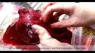 Placenta Encapsulation Explained IPEN [upl. by Baillieu511]