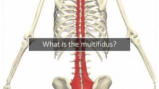 Multifidus Back Pain Why Your Doctor Never Discussed It [upl. by Anaimad]