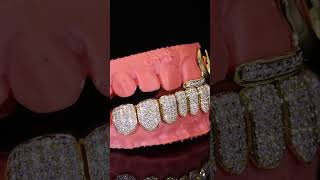 Moissanite Custom grillz with 18 yellow gold for a luxury look Icezeus Jewelry [upl. by Strong301]