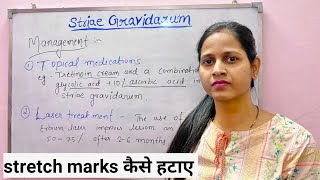 Striae Gravidarum  Stretch marks in pregnancy स्ट्रेच मार्क्स का बचाओ और इलाज [upl. by Anirpas]