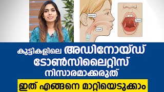 കുട്ടികളിലെ ജലദോഷം തൊണ്ടവേദന മൂക്കടപ്പ് കാരണം ഇതാണ്  Adenoid Tonsil Malayalam [upl. by Cioffred]