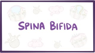 Spina bifida myelomeningocele meningocele occulta  causes symptoms treatment [upl. by Adnilrem]