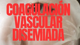 TRASTORNOS DE LA COAGULACIÓN  HEMATOLOGÍA  VILLAMEDIC [upl. by Retsev]