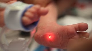 Sensors are first to monitor babies in the NICU [upl. by Blinny422]