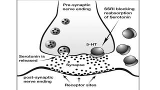 MiniLecture Use of SSRIs in Depression [upl. by Niran]