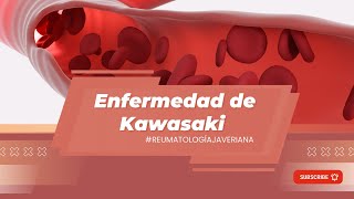 Enfermedad de Kawasaki [upl. by Yddub]