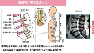 腰部疾患の診察手順 [upl. by Alatea]