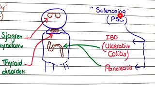 Primary Biliary Cholangitis and Primary Sclerosing Cholangitis  Pathology [upl. by Aliel467]