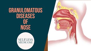 GRANULOMATOUS DISEASES OF NOSE part 1 Rhinoscleroma and syphylis in detail [upl. by Adlesirg]