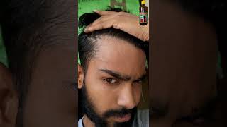 ADIVASI HAIR OIL REVIEW DAY 30 😱 adivasihairoil adivasihairoilreview shorts ytshorts minivlog [upl. by Joashus]