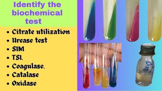 Biochemical Test  Bacterial Identification Technique Microbiology Practical Exam bacteriology [upl. by Ferdie]