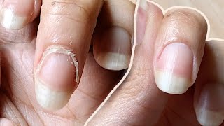 NAIL TRANSFORMATION  how I CUT CUTICLES at HOME  Basic Tools ONLY [upl. by Burn]