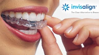 Watch this video before starting INVISALIGN  Starter Kit  Price  Dental Treatment [upl. by Virginia]