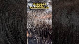 Lice removalhow to remove lice from hairlice treatment in parlourhow to prevent from licelice [upl. by Lowrance]