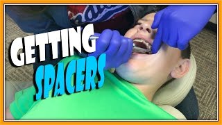 GETTING SPACERS FOR MY BRACES  ERIKTV365 [upl. by Cantu]