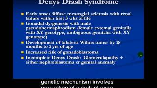 Congenital Nephrotic Syndrome [upl. by Alby]