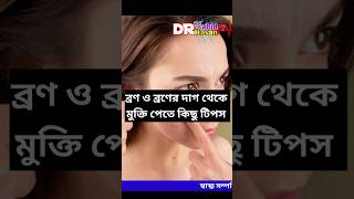 ব্রণ বা ব্রণের দাগ দুর করার উপায়  ব্রণের দাগ থেকে মুক্তি পাবো কিভবে ব্রণদূরকরারউপায় ব্রণ [upl. by Pet]