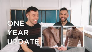 VASER LIPOSUCTION UPDATE ONE YEAR LATER [upl. by Ace308]