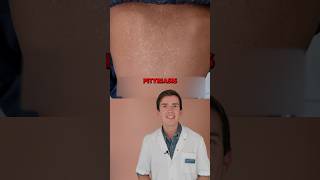 🦠 Le Pityriasis Versicolor  une infection cutanée superficielle bénigne 📚 [upl. by Christian272]