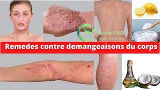 COMMENT CALMER LES DÉMANGEAISONS DU CORPS  Rama Health amp Beauty [upl. by Castro]