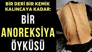 Bir Deri Bir Kemik Kalıncaya Kadar Bir ANOREKSİYA Öyküsü [upl. by Milda]