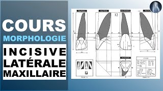 Morphologie  Incisive latérale maxillaire  Prothèse dentaire  Cours  © [upl. by Tennos]