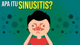 Apa itu Sinusitis [upl. by Remy]