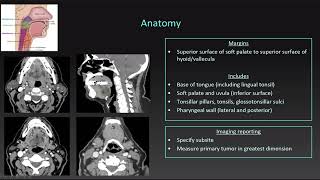 02 TNM Staging Oropharynx [upl. by Ima]