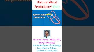 Balloon Atrial Septostomy [upl. by Adnwahs27]