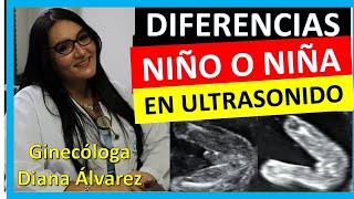 Â¿cÃ³mo se ve si es NIÃ‘O o NIÃ‘A por ULTRASONIDO SEMANA 12 A 20 por GINECOLOGA DIANA ALVAREZ [upl. by Assetnoc]