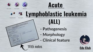 ALL Acute Lymphoblastic LeukemiaLymphoma  Disorders of White Cells  Lymphoid neoplasm Pathology [upl. by Bridgid]